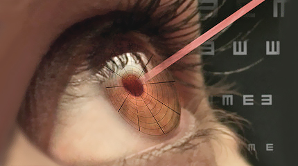 AGARAWAL EYE INSTITUTE 