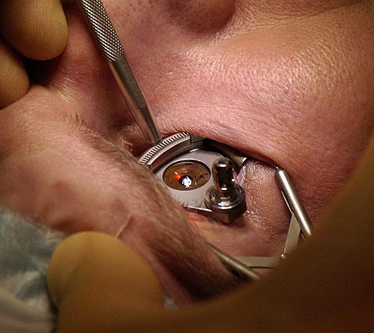 DEWAN MEMORIAL EYE HOSPITAL 