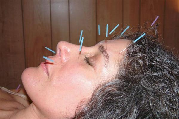 PSYCHO ACUPUNCTURE & MEDICARE CENTRE