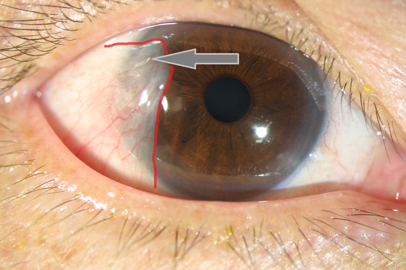 EYE CARE CLINIC